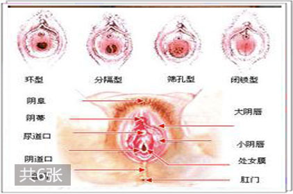 女性外用生殖器全解